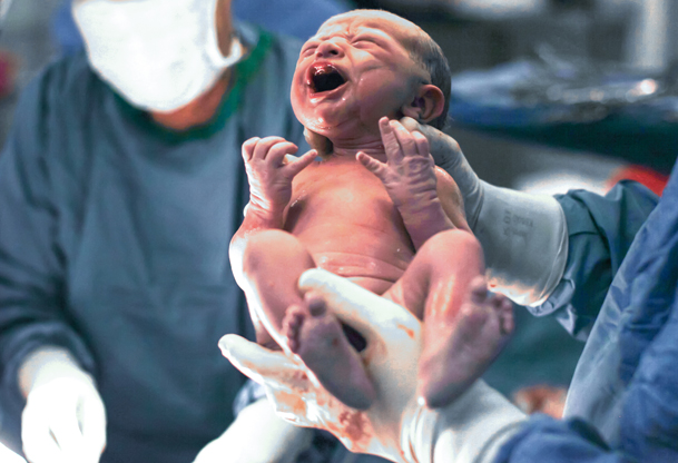 زایمان فیزیولوژیک