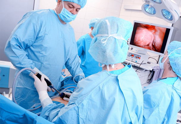 لاپاراسکوپی رحم