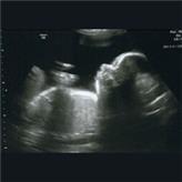 پره ناتولوژی (Prenatology) (ارزیابی جنین در دوران بارداری)